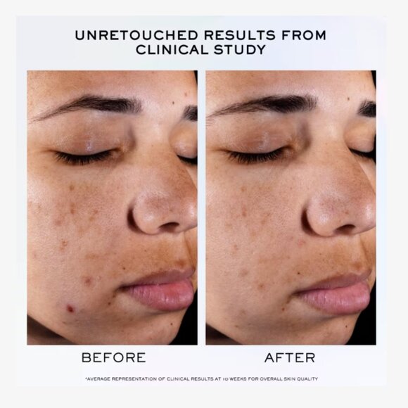 Lancôme Clarifique Pro-Solution Brightening & Dark Spot Reducing Serum 1oz | NEW - Picture 4 of 5